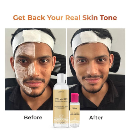 Tan Vanish Glutai Kojic Lotion and Gluta Kojic Serum 100 ml